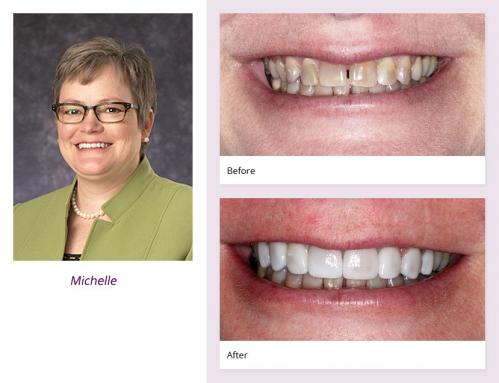 Dentist in Hopkins, MN -  